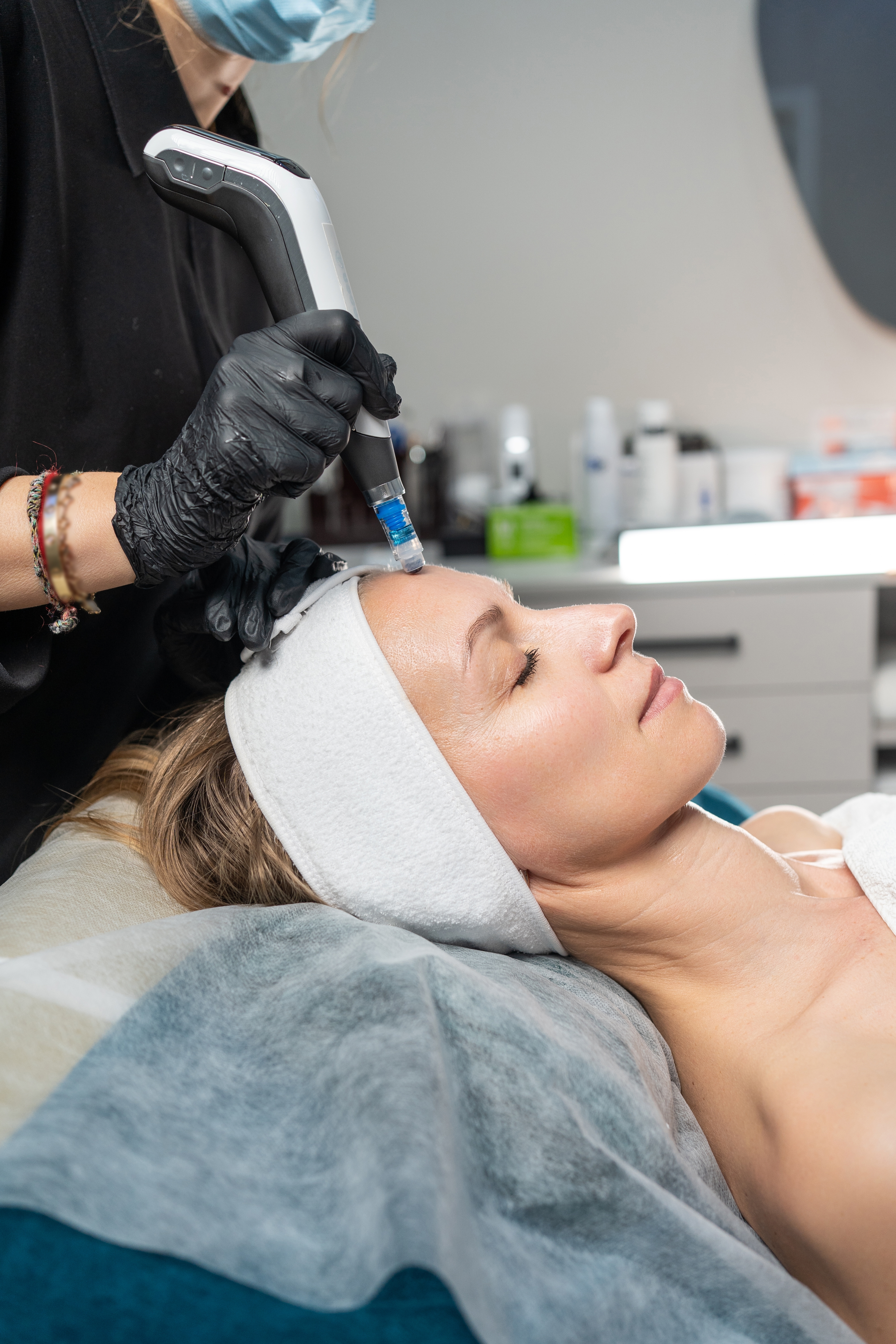 Microneedling with PRF treatment at Desert Med Rejuvenation in Rancho Mirage.