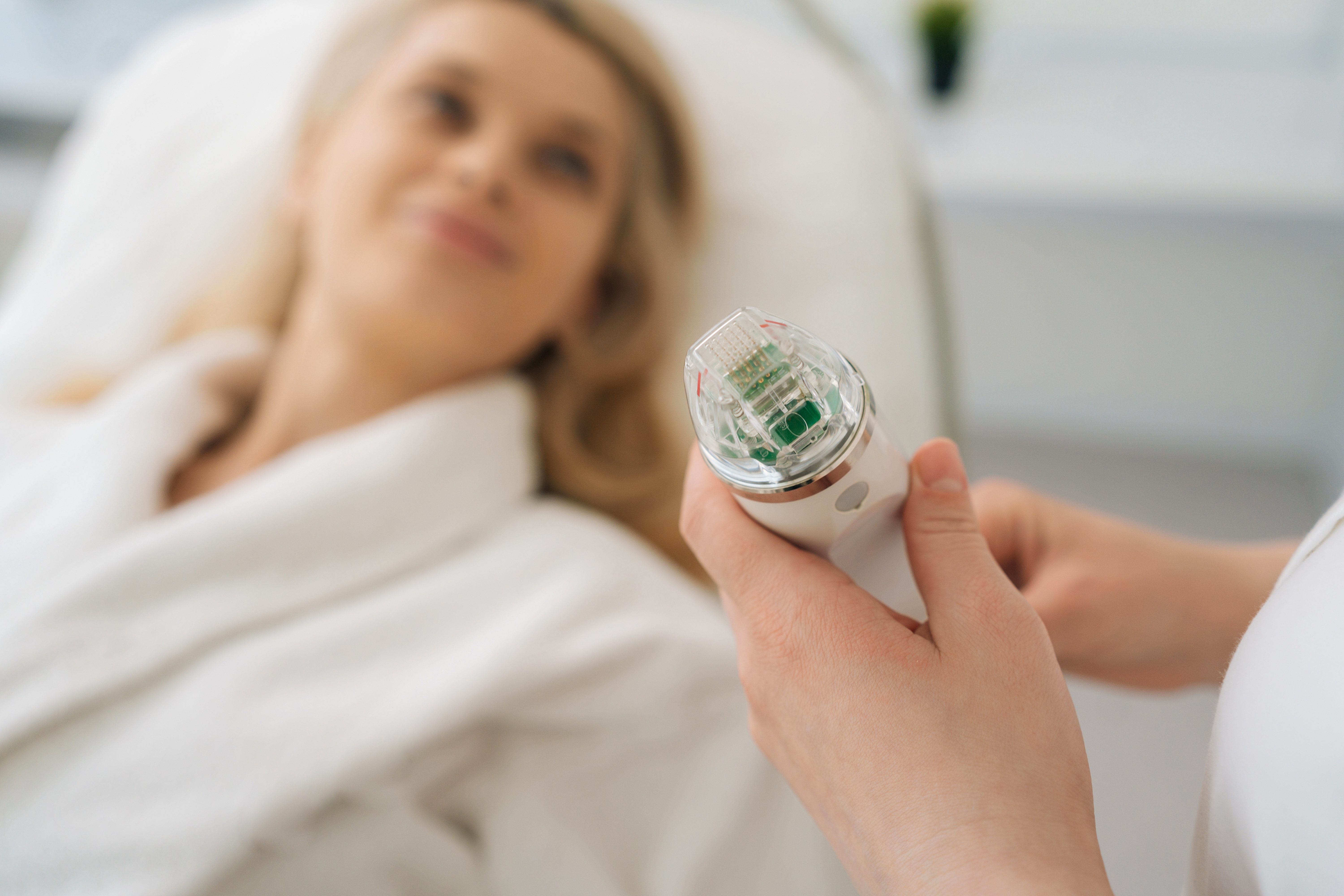 RF Microneedling treatment areas on the face, neck and décolletage at Desert Med Rejuvenation.