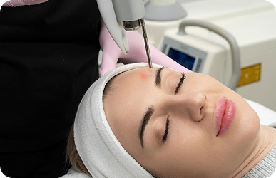 CO2 laser skin resurfacing available through Desert Med Rejuvenation at the La Quinta sister office.