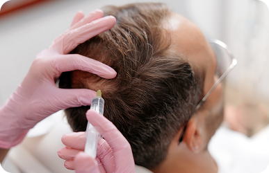 PRF hair restoration treatment at Desert Med Rejuvenation.