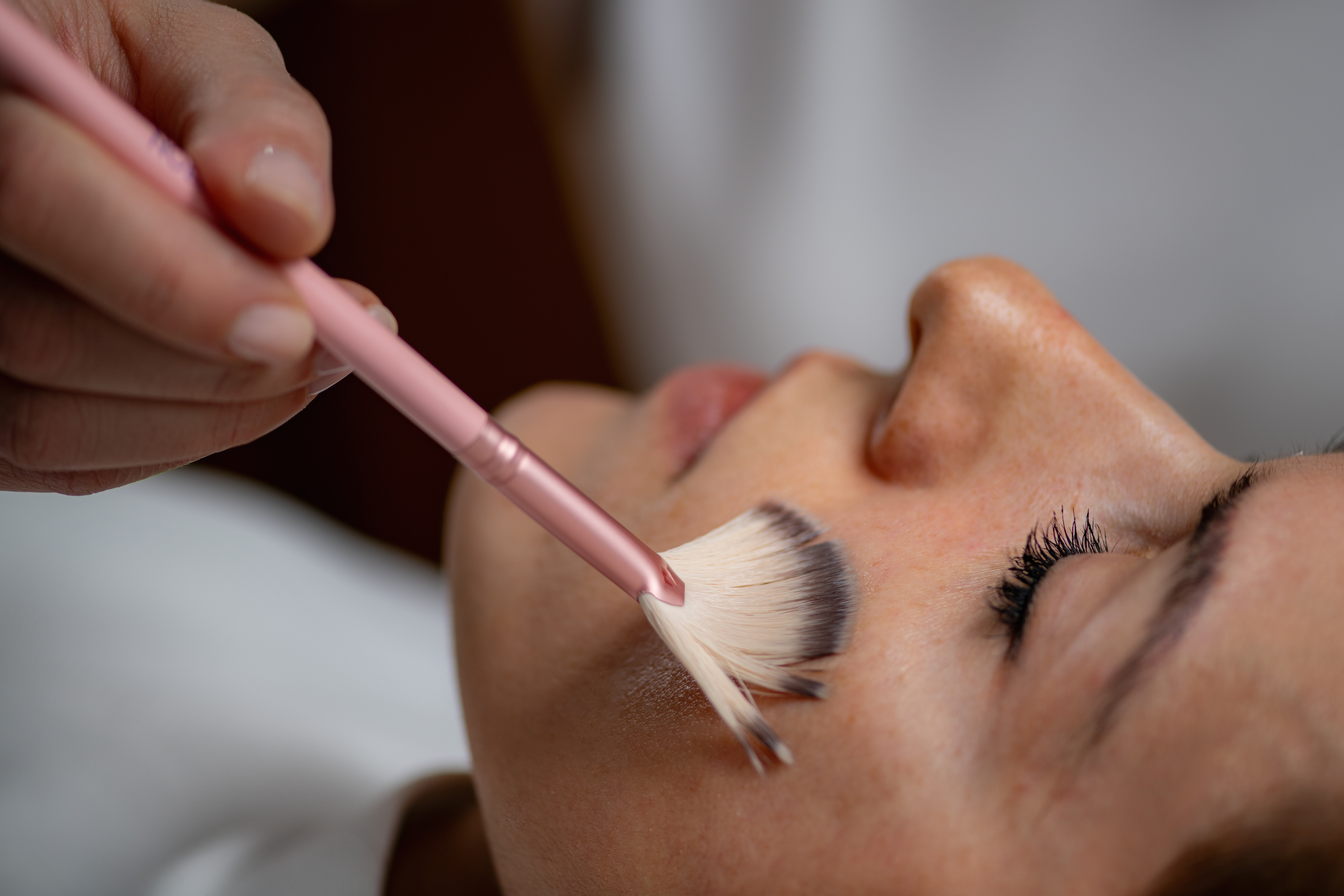 VI Peel medical-grade chemical peel at Desert Med Rejuvenation in Rancho Mirage.