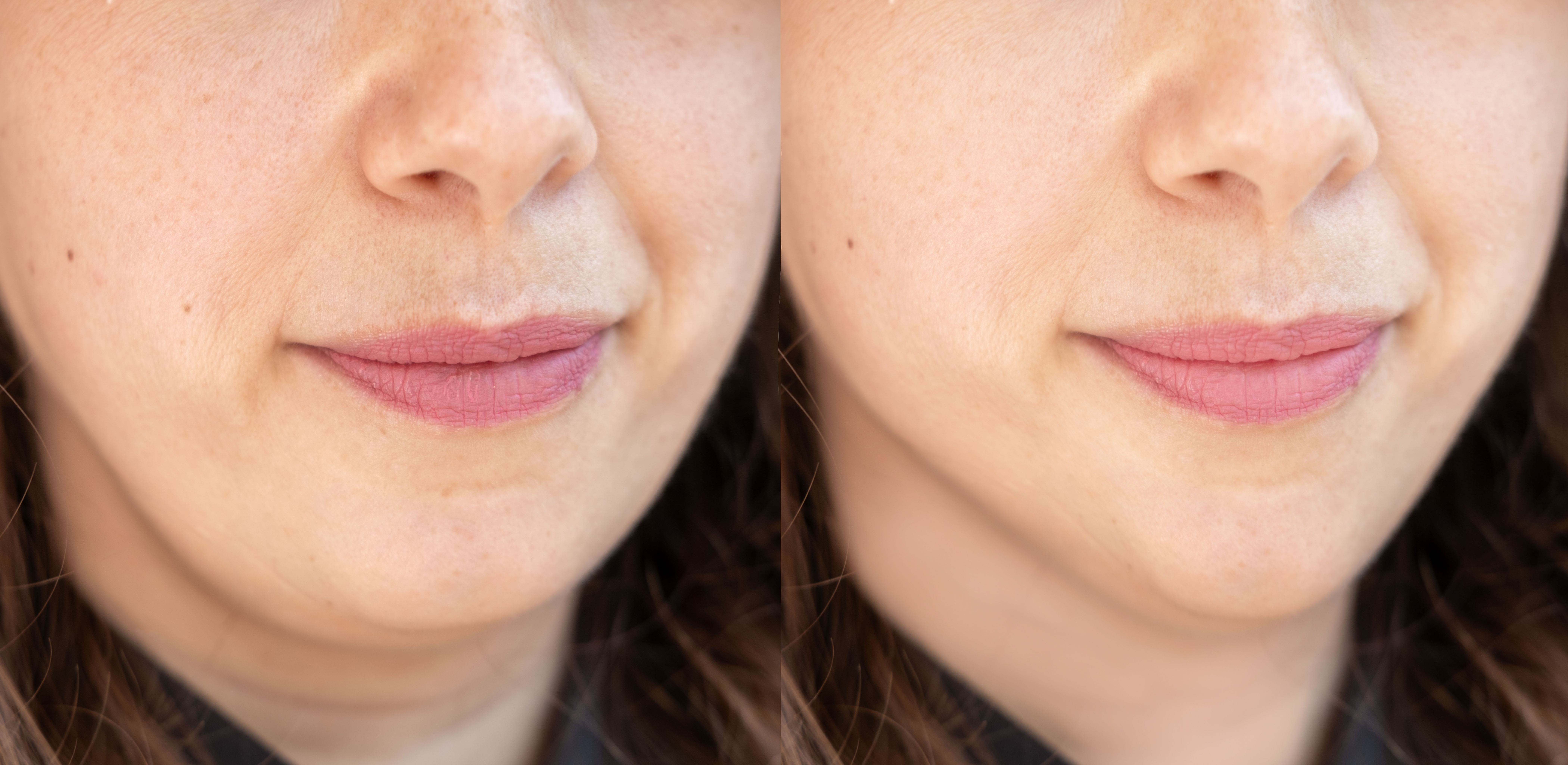 Woman with bright, even-toned skin after a VI Peel at Desert Med Rejuvenation.